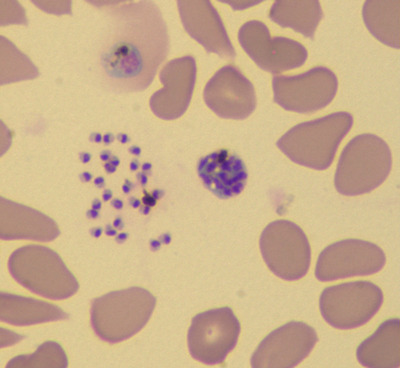 UCR Newsroom: How the Malaria Parasite Spreads in Red Blood Cells